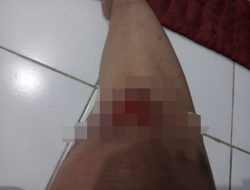 Karyawan Di Hantui Kawanan Begal,Pinta Petugas Ungkap Pelaku